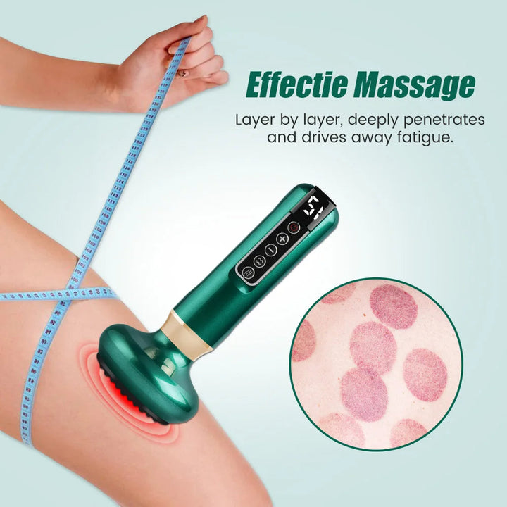 Vacuümzuigtherapie