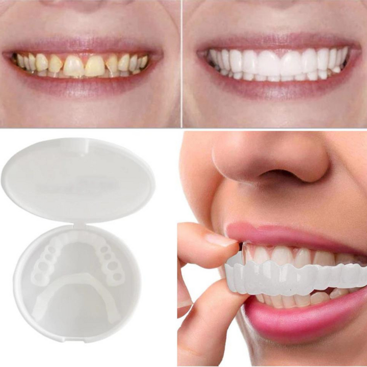 ClearSmile – EasyClick Gebit Prothese voor een Stralende Glimlach