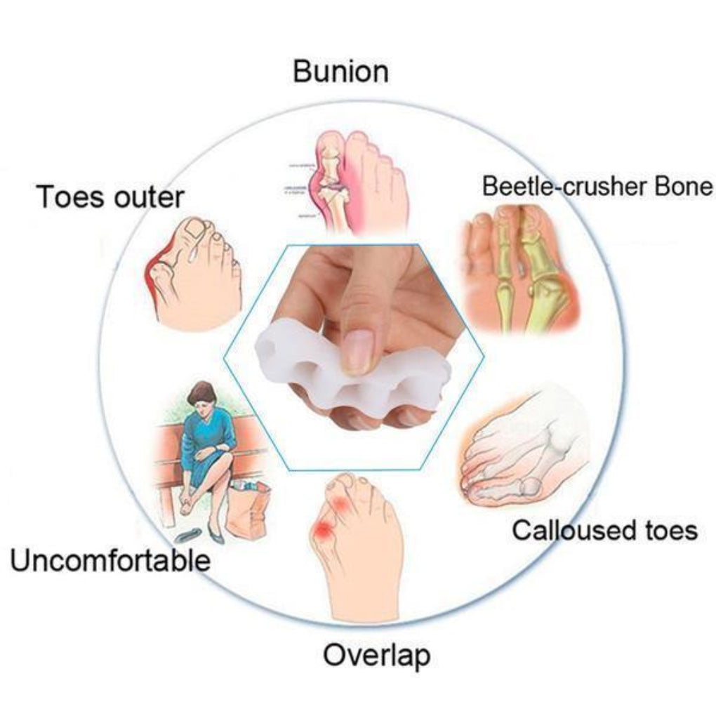 Orthopedische teencorrector - Teenspreider