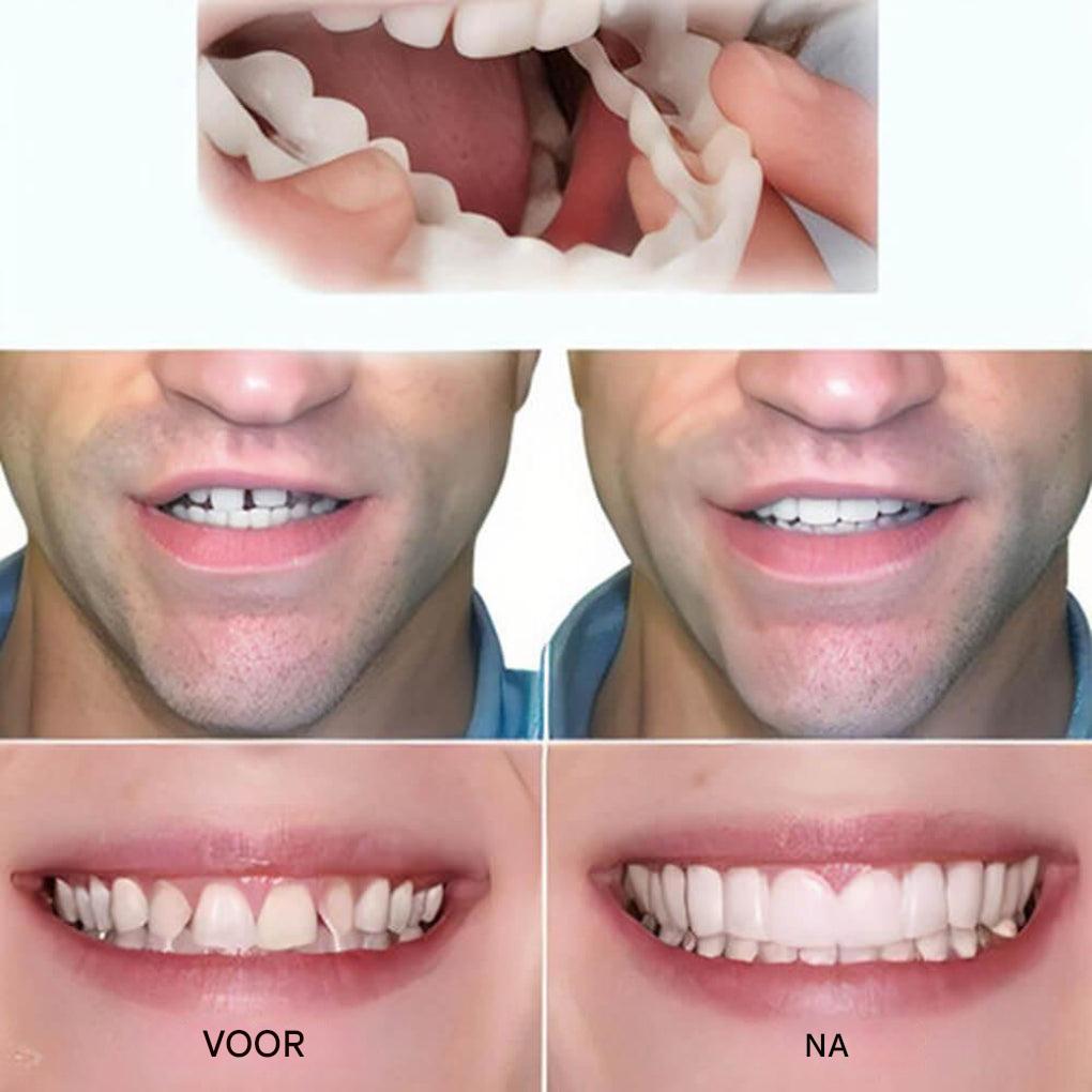 Clip-on facings – Lach met vertrouwen