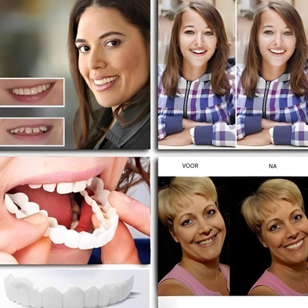 Clip-on facings – Lach met vertrouwen